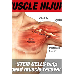 Illustration of muscle injury showing details of chest muscles and the role of stem cells in recovery.