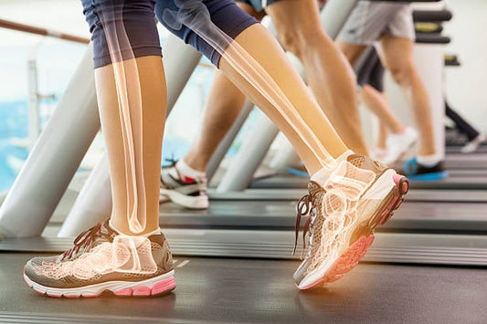 Anatomy of leg bones in motion while walking on a treadmill for exercise.